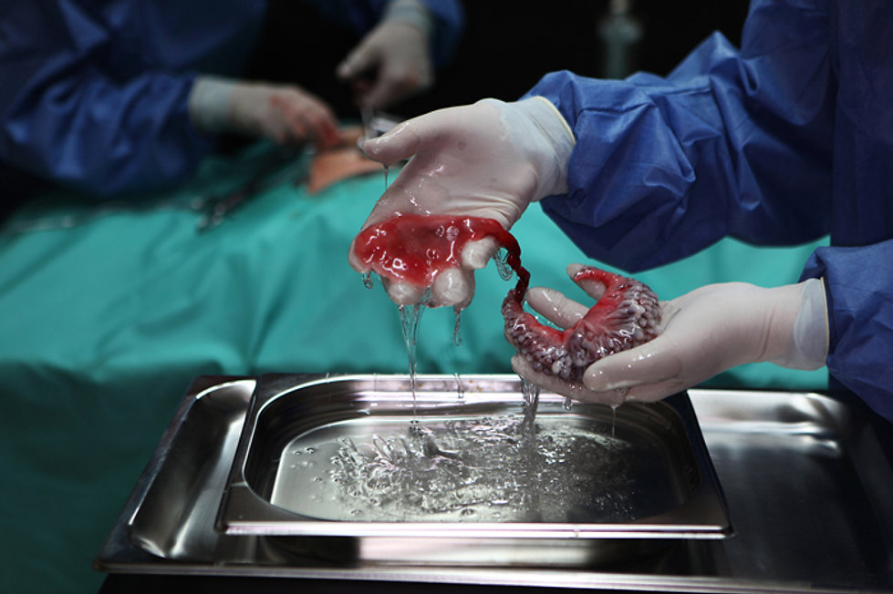 Circumventive Organs — Electrostabilis Cardium